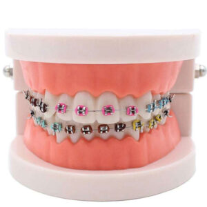 Orthodontic-Teeth-Model