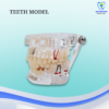 Teeth Model (With Dental Disease)
