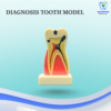 Diagnosis Tooth Model