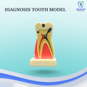 Diagnosis Tooth Model